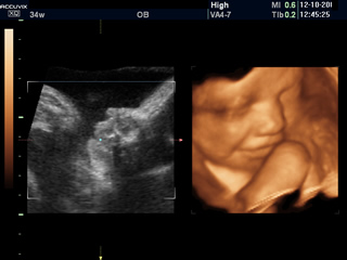 産婦人科 個室 入院